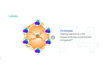 Ready to diagnose HCV?