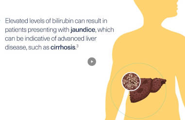 Ready to diagnose HCV?