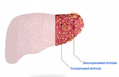 Ready to diagnose HCV?